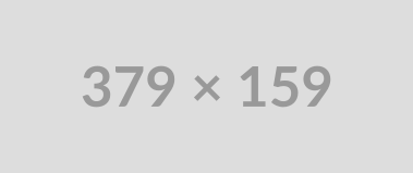 379x159